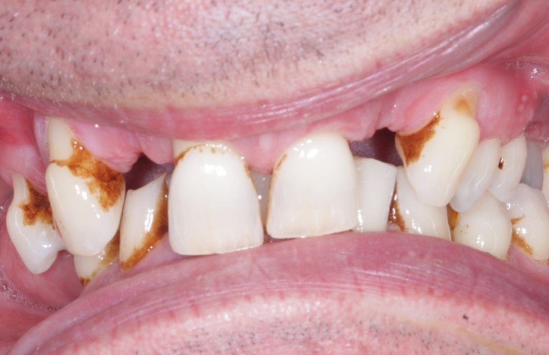 Before — placeholder image, replace with a real consented patient photo